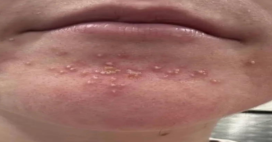 Be careful! These are the consequences of sleeping with the…