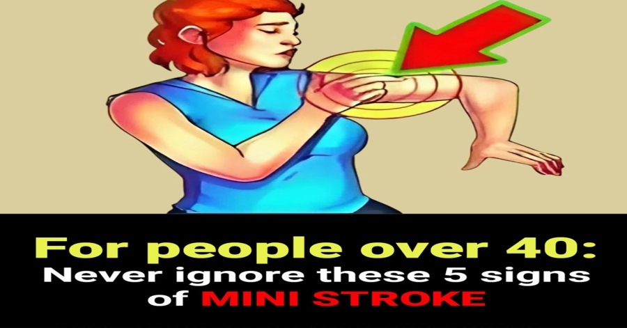 Mini Stroke in People Over 40: What You Need to Know