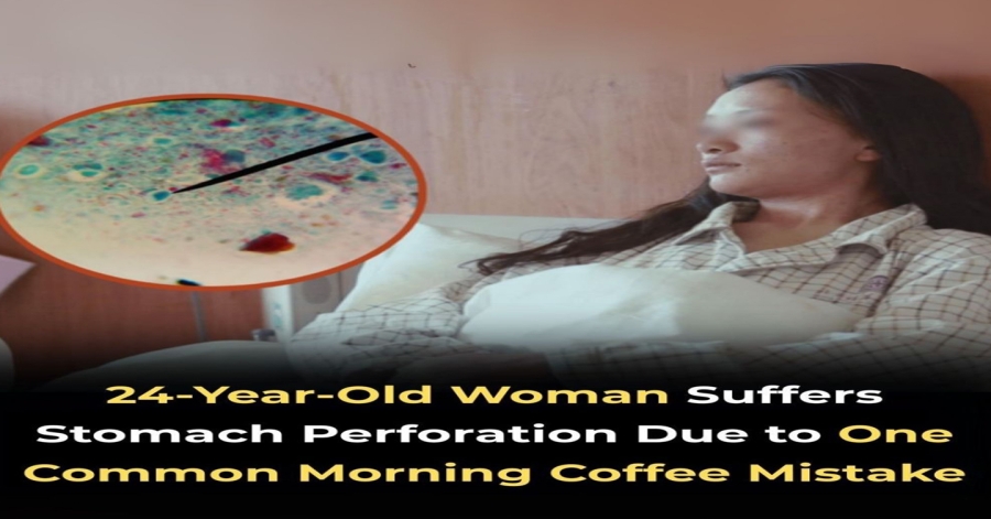 24-Year-Old Woman Suffers Stomach Perforation Due to One Common Morning Coffee Mistake