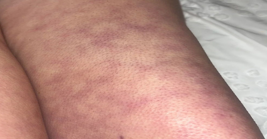 These are the consequences of sleeping with the…