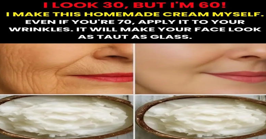 My aunt taught me how to prepare my own homemade cream to remove wrinkles and blackheads.