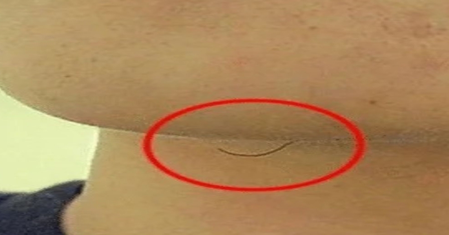 If you have chin hair: here’s what it really means.