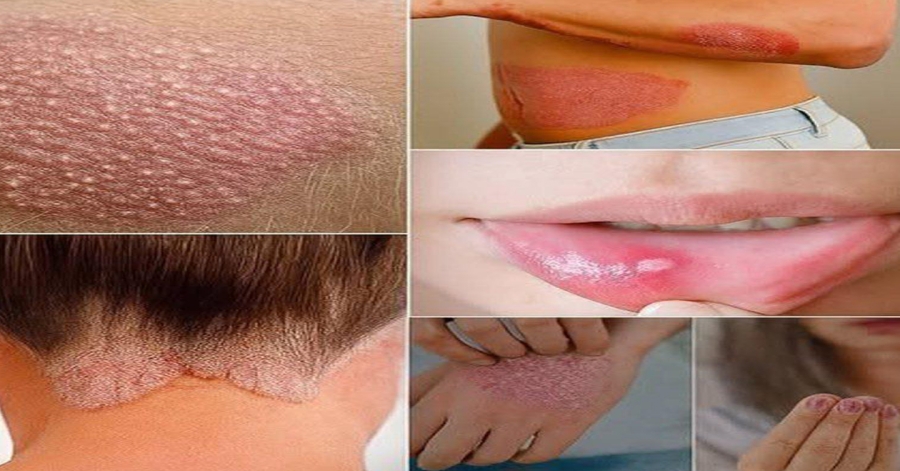 Signs you should know if you have this thing called da…