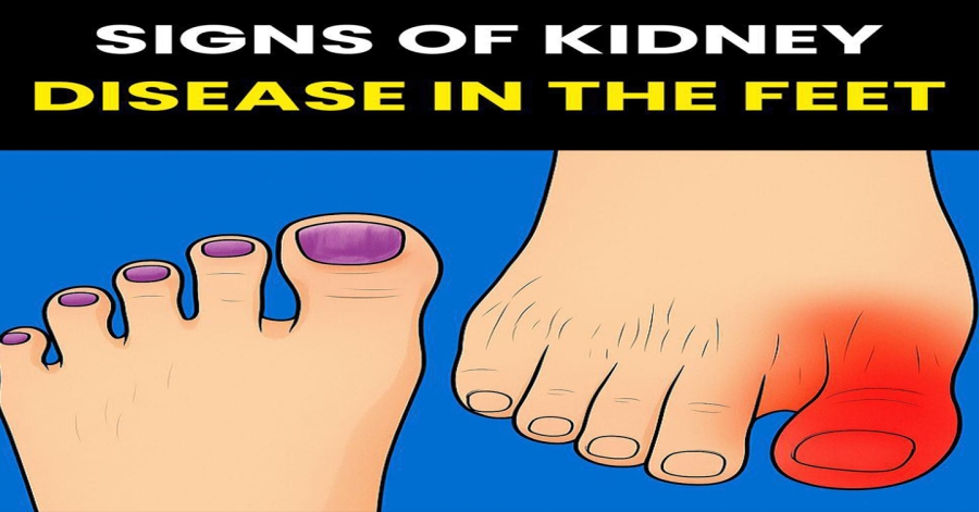 What your feet reveal about your kidneys