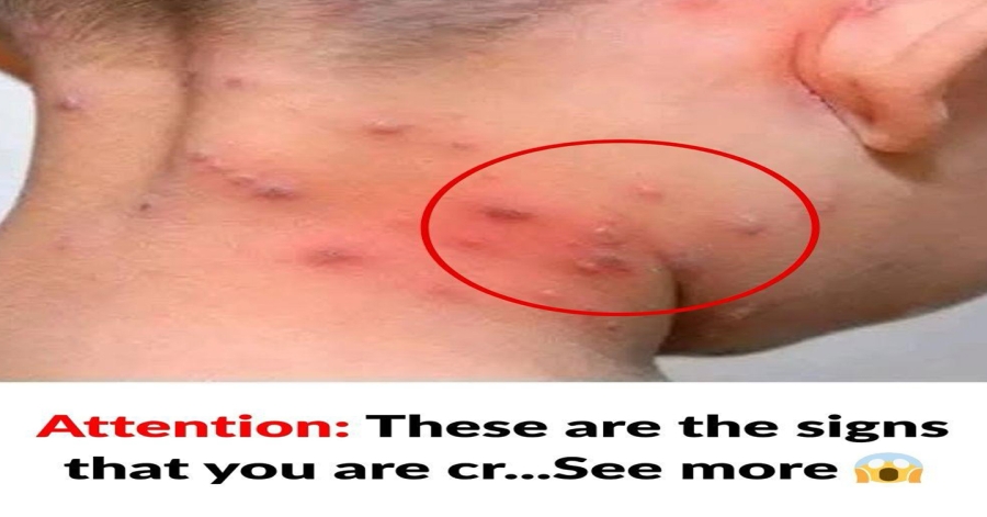 The Most Common Skin Rashes in Older Adults
