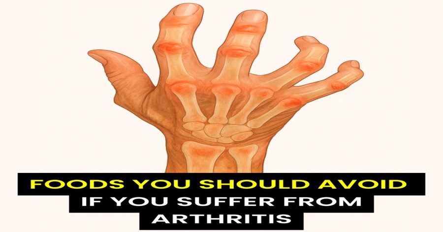 10 foods to avoid to prevent and relieve arthritis symptoms