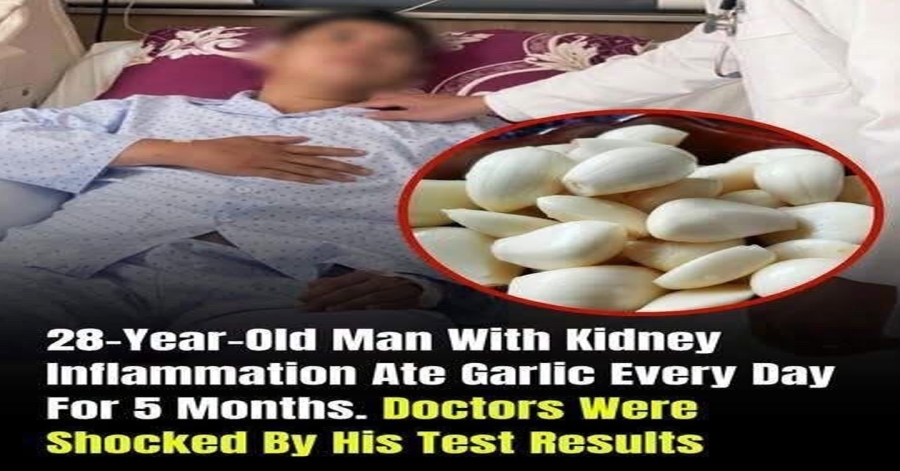 He Ate Garlic Every Day for 5 Months — What Happened to His Kidneys Surprised Doctors