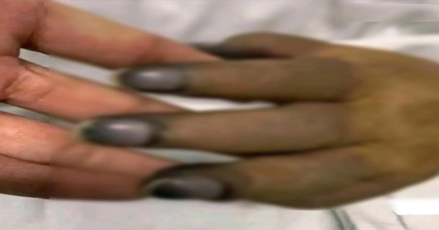 These are the consequences of painting your nails with